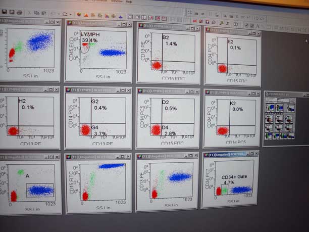 Flow Cytometry – What is it?