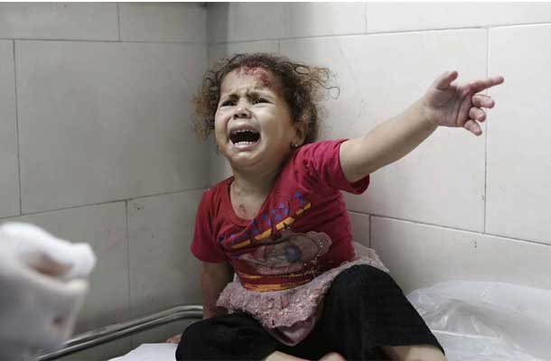 A little girl cries as medics attend to her injuries at al-Shifa hospital, Gaza City (18 July). UNICEF/Eyad El Baba