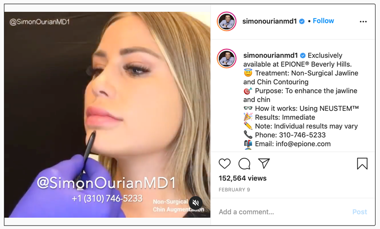 Non-surgical jawline and chin contouring