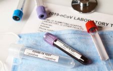 coronavirus-covid-2019-test-concept-2FUB48H