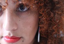 The Use of Dr. Ourian’s Coolaser® to Treat Melasma Melasma is an extremely common skin condition causing discoloration on the face. Using the Epione-exclusive Coolaser technique to treat this condition is growing in popularity.