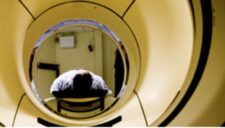 concussion-MRI