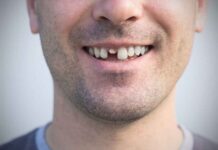 How to Handle a Chipped or Broken Tooth While Waiting for an Emergency Dentist