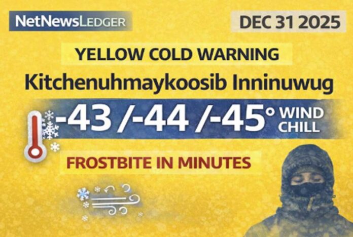 Kitchenuhmaykoosib Inninuwug (Big Trout Lake–Kasabonika) weather for Dec. 31, 2025: Yellow Cold Warning with extreme wind chills of -40 to -45 and gusty winds up to 60 km/h. Frostbite can occur in minutes; flurries possible today and tonight.