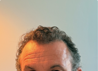 Understanding Chronic Venous Insufficiency and Endovenous Ablation with Insights from Michael Lebow, MD