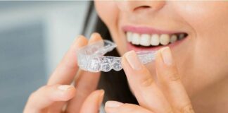 What to Expect During Your First Orthodontic Visit Photo by Arvind Philomin: https://www.pexels.com/photo/woman-with-corrective-brace-11887613/