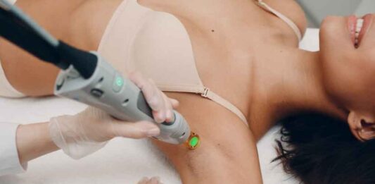 How to Manage Pain During Underarm Laser Treatment Laser surgery