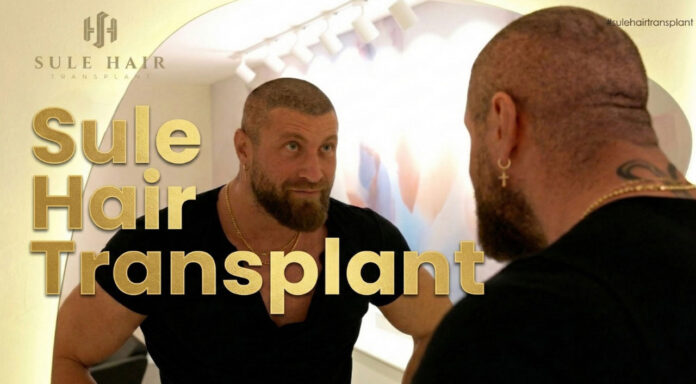 Hair transplant